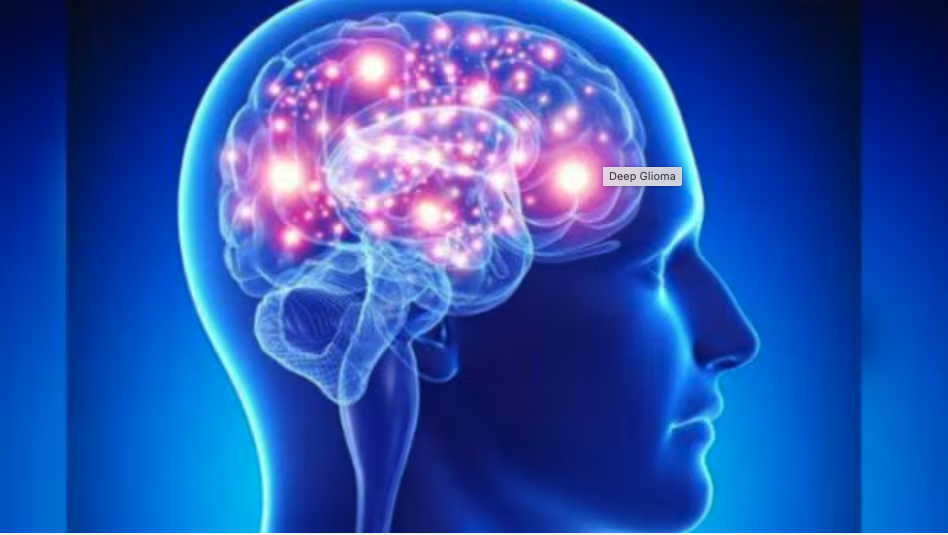deep glioma